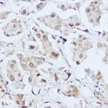 Immunohistochemistry - Anti-Gli1 Antibody (A87616) - Antibodies.com