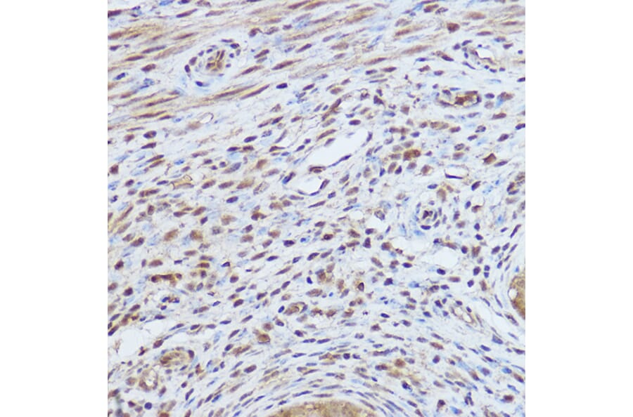 Immunohistochemistry - Anti-Gli1 Antibody (A87616) - Antibodies.com