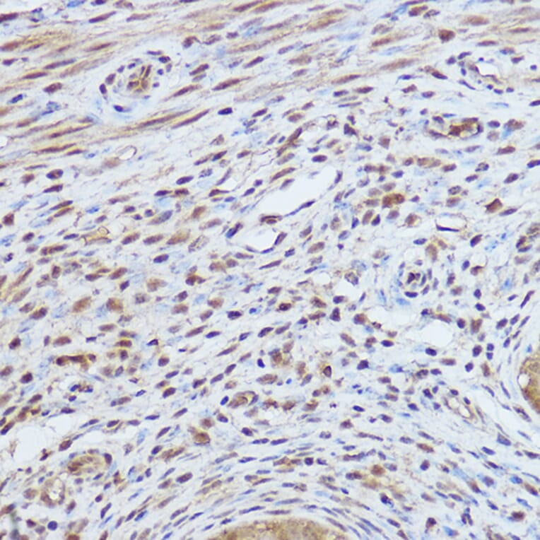 Immunohistochemistry - Anti-Gli1 Antibody (A87616) - Antibodies.com