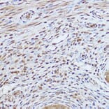 Immunohistochemistry - Anti-Gli1 Antibody (A87616) - Antibodies.com