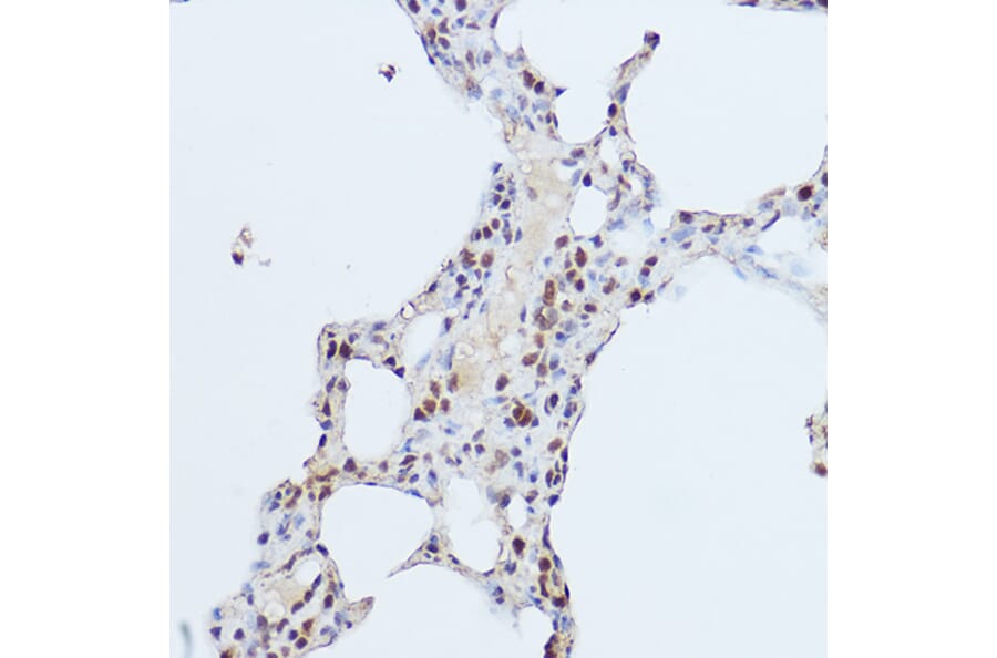 Immunohistochemistry - Anti-Gli1 Antibody (A87616) - Antibodies.com