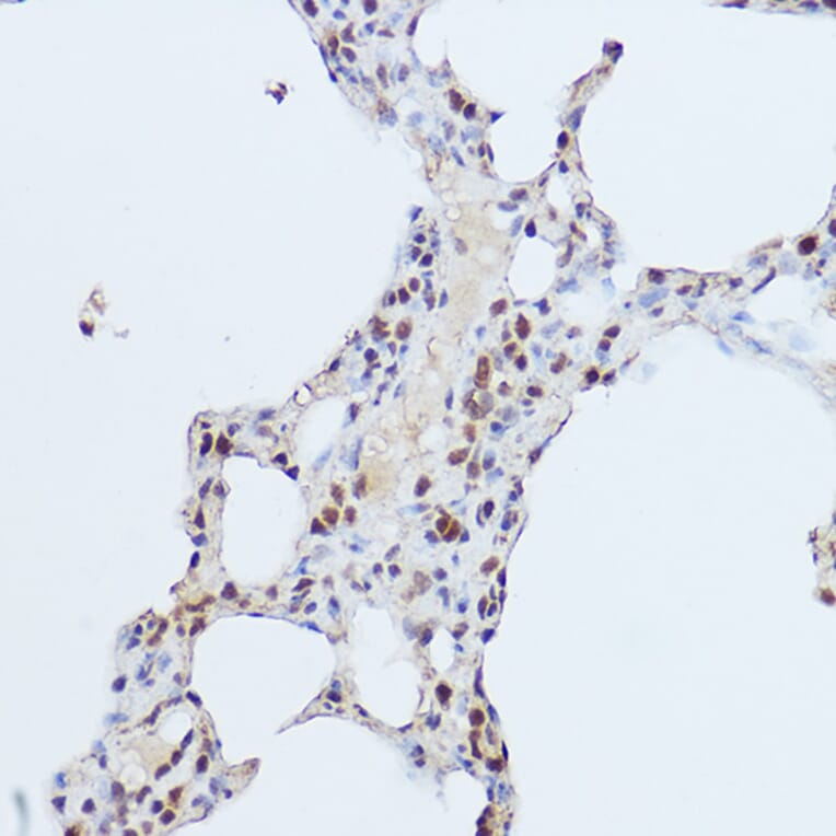 Immunohistochemistry - Anti-Gli1 Antibody (A87616) - Antibodies.com