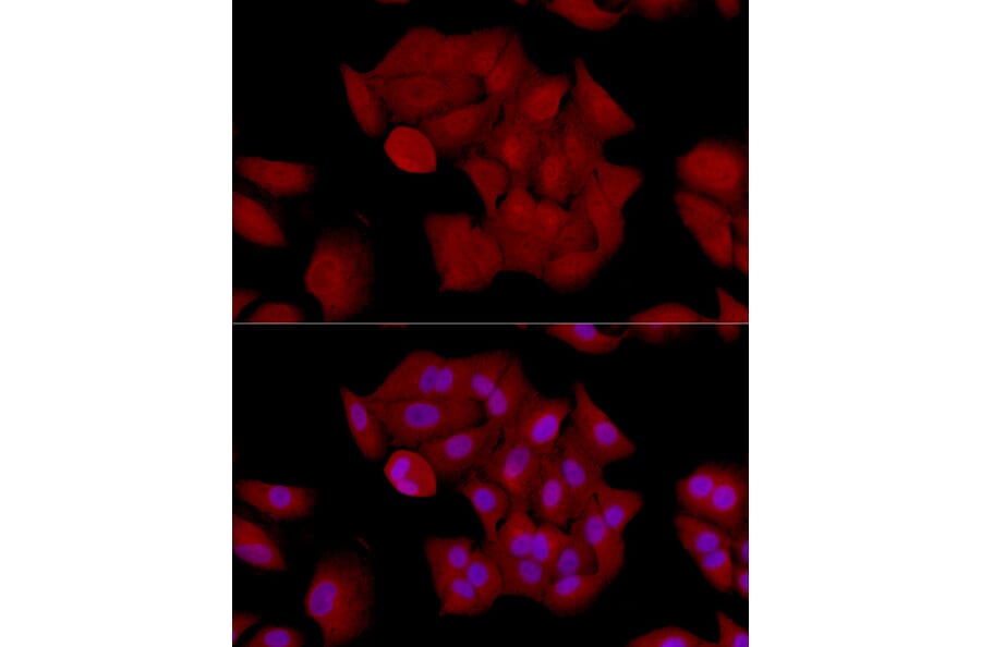 Immunofluorescence - Anti-Gli1 Antibody (A87616) - Antibodies.com