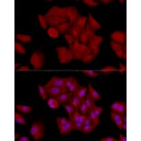 Immunofluorescence - Anti-Gli1 Antibody (A87616) - Antibodies.com