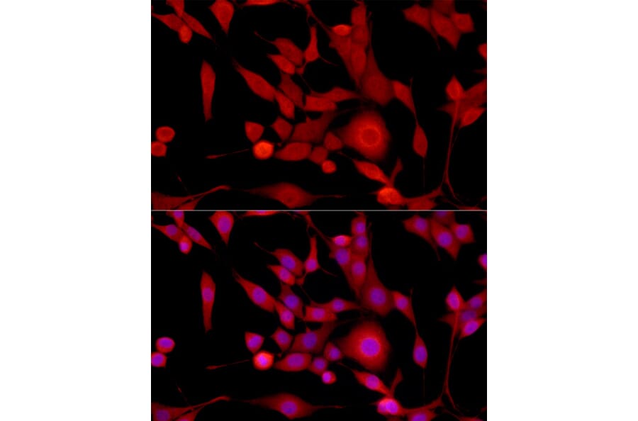 Immunofluorescence - Anti-Gli1 Antibody (A87616) - Antibodies.com