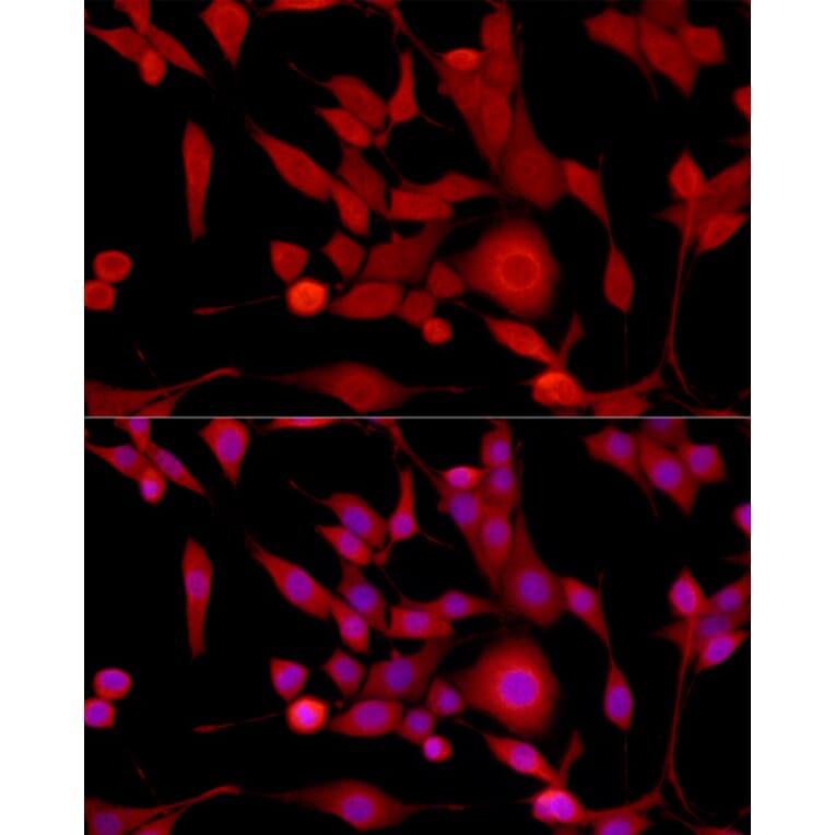 Immunofluorescence - Anti-Gli1 Antibody (A87616) - Antibodies.com