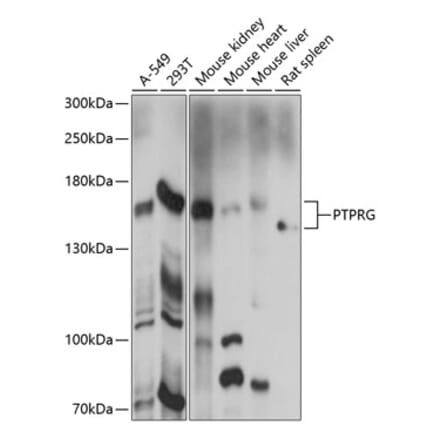 Western Blot - Anti-PTPRG Antibody (A87617) - Antibodies.com