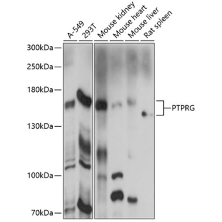 Western Blot - Anti-PTPRG Antibody (A87617) - Antibodies.com