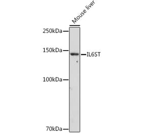 Western Blot - Anti-CD130 (gp130) Antibody (A87618) - Antibodies.com
