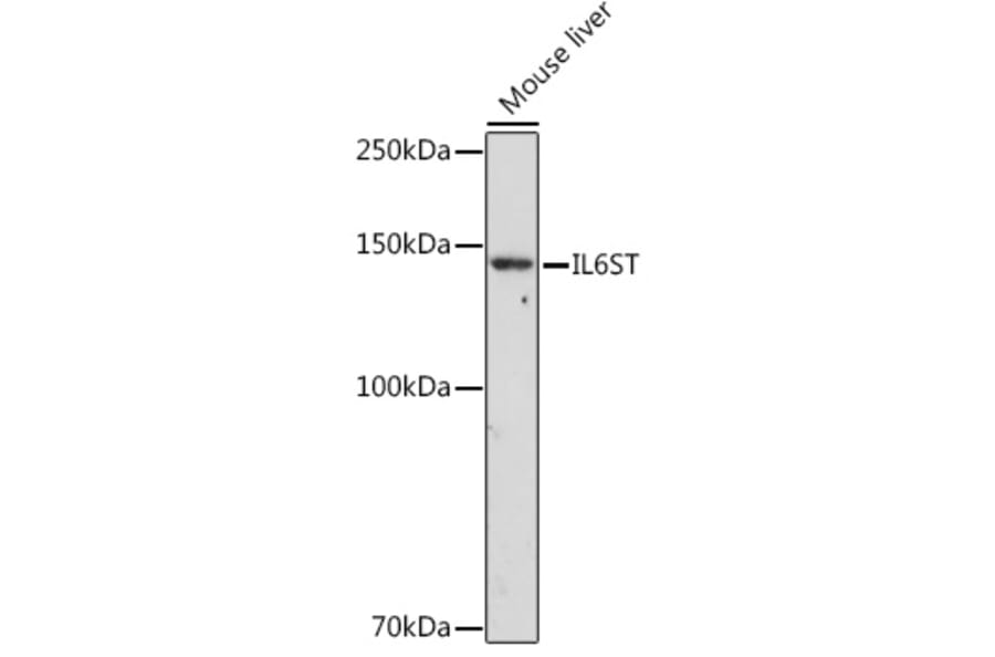 Western Blot - Anti-CD130 (gp130) Antibody (A87618) - Antibodies.com