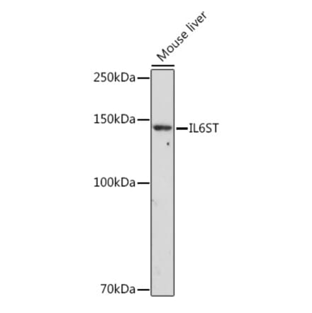 Western Blot - Anti-CD130 (gp130) Antibody (A87618) - Antibodies.com