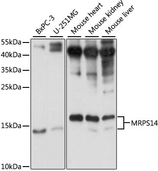 Western blot analysis of extracts of various cell lines, using Anti-MRPS14 Antibody (A15498) at 1:1,000 dilution.
Secondary antibody: Goat Anti-Rabbit IgG (H+L) (HRP) (AS014) at 1:10,000 dilution.
Lysates / proteins: 25µg per lane.
Blocking buffer: 3% non-fat dry milk in TBST.
Detection: ECL Basic Kit (RM00020).
Exposure time: 10s.