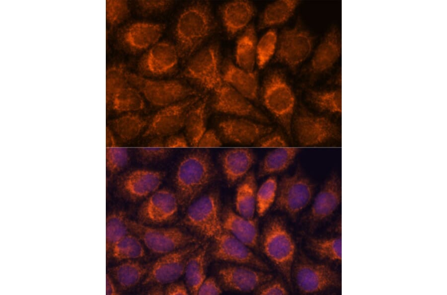 Immunofluorescence - Anti-MRPS14 Antibody (A87619) - Antibodies.com