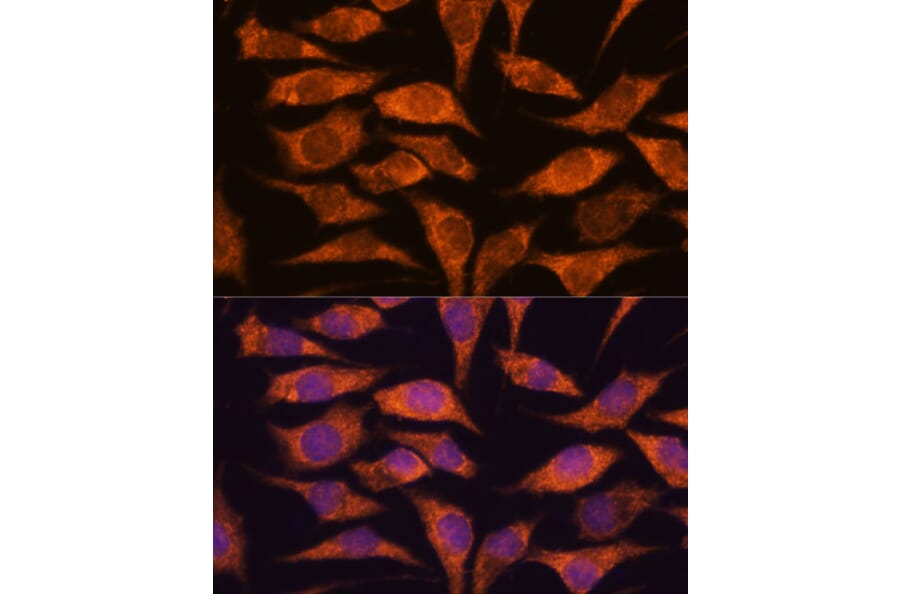 Immunofluorescence - Anti-MRPS14 Antibody (A87619) - Antibodies.com