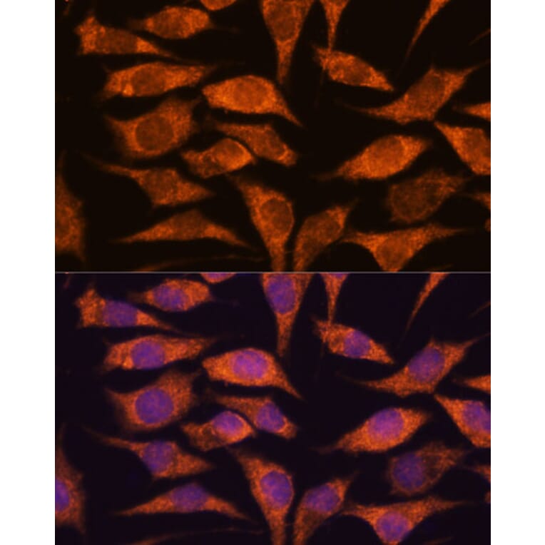 Immunofluorescence - Anti-MRPS14 Antibody (A87619) - Antibodies.com