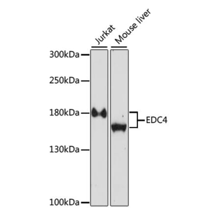 Western Blot - Anti-EDC4 Antibody (A87621) - Antibodies.com