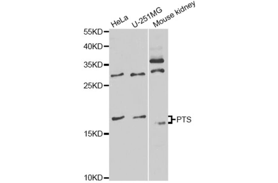 Western Blot - Anti-PTS Antibody (A14055) - Antibodies.com