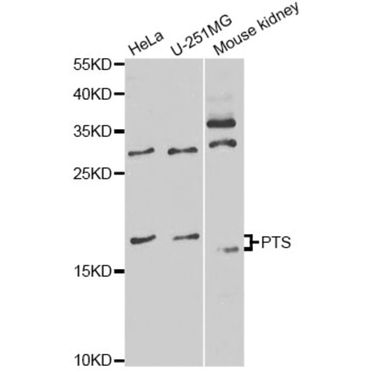 Western Blot - Anti-PTS Antibody (A14055) - Antibodies.com