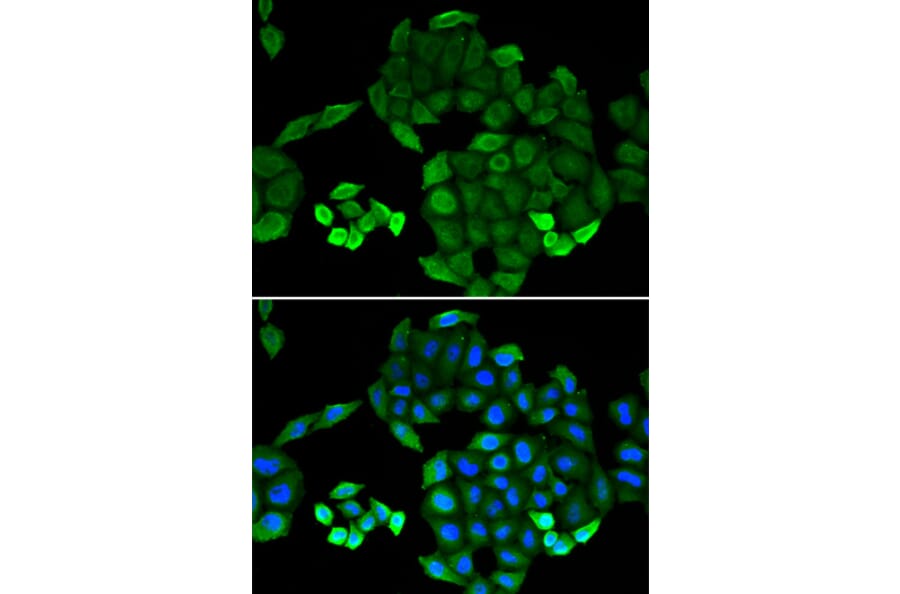 Immunofluorescence - Anti-PTS Antibody (A14055) - Antibodies.com