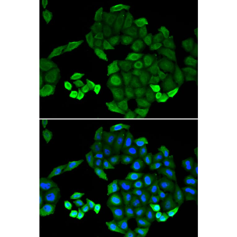 Immunofluorescence - Anti-PTS Antibody (A14055) - Antibodies.com
