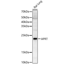 Western Blot - Anti-APRT Antibody (A87623) - Antibodies.com