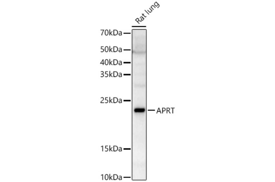 Western Blot - Anti-APRT Antibody (A87623) - Antibodies.com