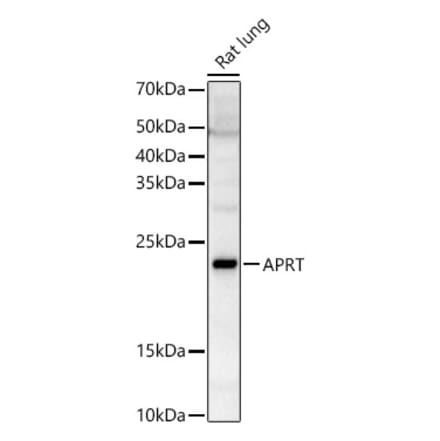 Western Blot - Anti-APRT Antibody (A87623) - Antibodies.com