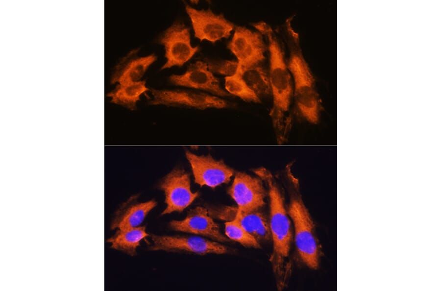 Immunofluorescence - Anti-APRT Antibody (A87623) - Antibodies.com