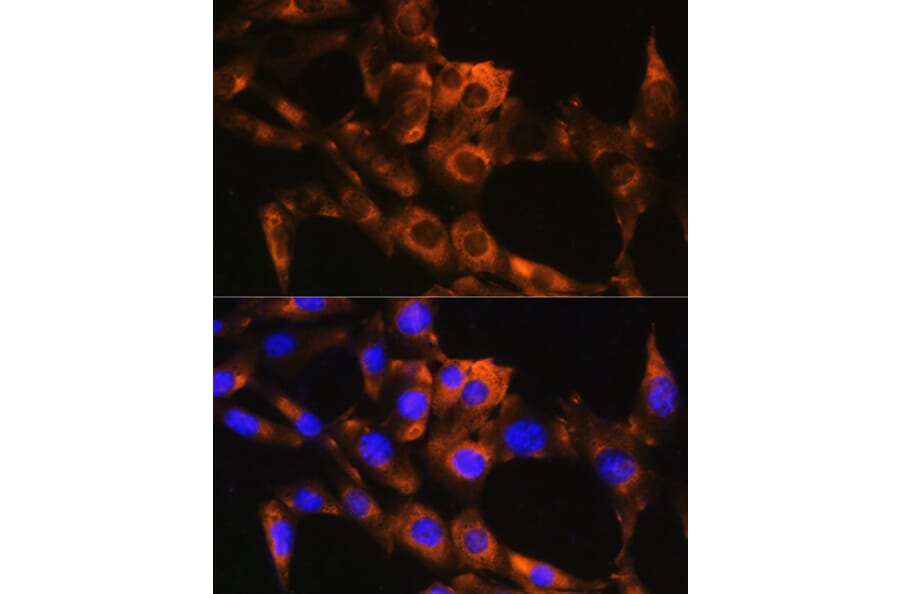 Immunofluorescence - Anti-APRT Antibody (A87623) - Antibodies.com