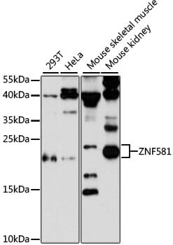 Western blot analysis of extracts of various cell lines, using Anti-ZNF581 Antibody (A13162) at 1:3000 dilution.
Secondary antibody: Goat Anti-Rabbit IgG (H+L) (HRP) (AS014) at 1:10,000 dilution.
Lysates / proteins: 25µg per lane.
Blocking buffer: 3% non-fat dry milk in TBST.
Detection: ECL Enhanced Kit (RM00021).
Exposure time: 90s.