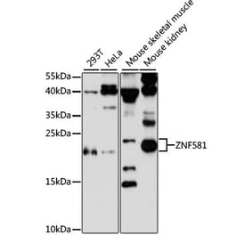 Western Blot - Anti-ZNF581 Antibody (A87624) - Antibodies.com