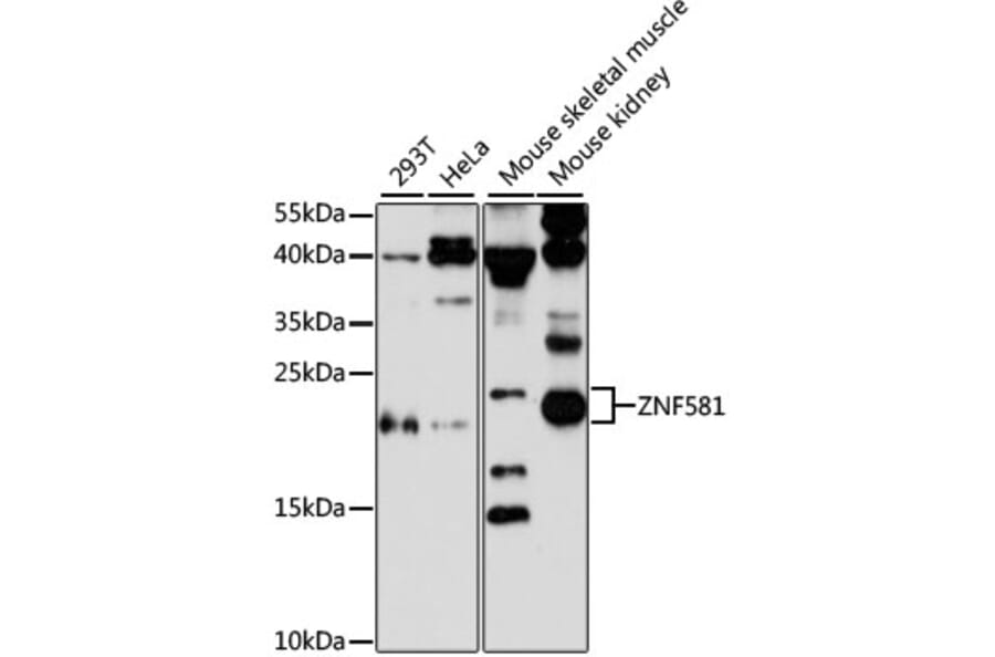 Western Blot - Anti-ZNF581 Antibody (A87624) - Antibodies.com