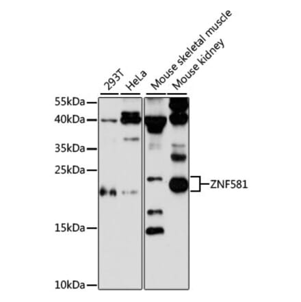 Western Blot - Anti-ZNF581 Antibody (A87624) - Antibodies.com