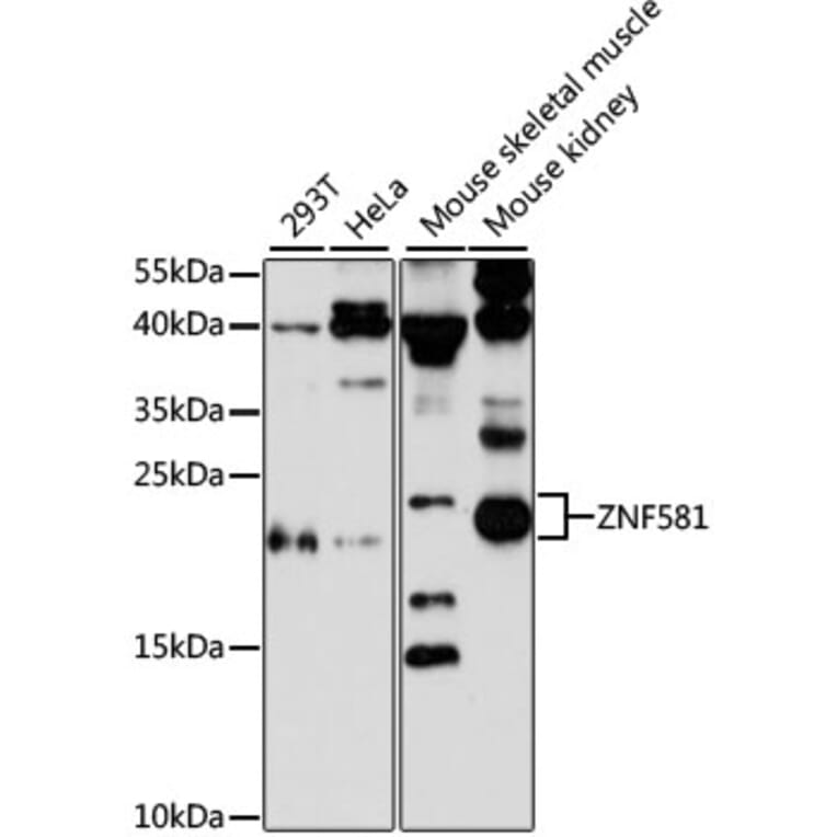 Western Blot - Anti-ZNF581 Antibody (A87624) - Antibodies.com