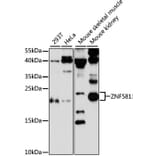 Western Blot - Anti-ZNF581 Antibody (A87624) - Antibodies.com
