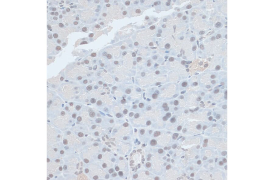 Immunohistochemistry - Anti-ZNF581 Antibody (A87624) - Antibodies.com