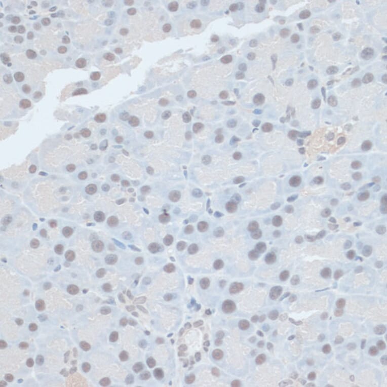 Immunohistochemistry - Anti-ZNF581 Antibody (A87624) - Antibodies.com