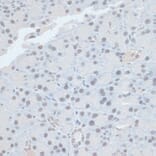 Immunohistochemistry - Anti-ZNF581 Antibody (A87624) - Antibodies.com