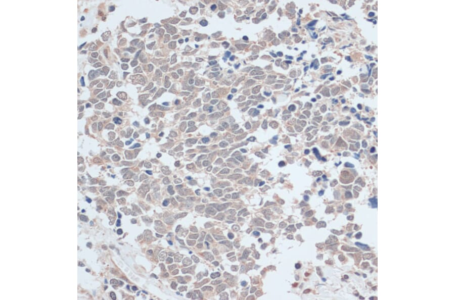 Immunohistochemistry - Anti-ZNF581 Antibody (A87624) - Antibodies.com