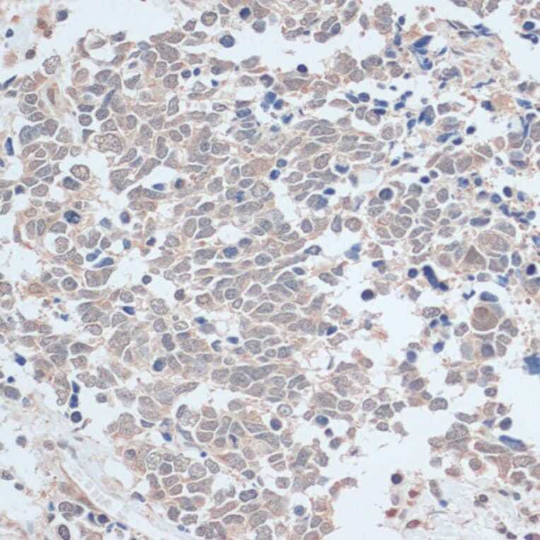 Immunohistochemistry - Anti-ZNF581 Antibody (A87624) - Antibodies.com