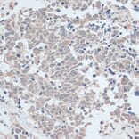 Immunohistochemistry - Anti-ZNF581 Antibody (A87624) - Antibodies.com