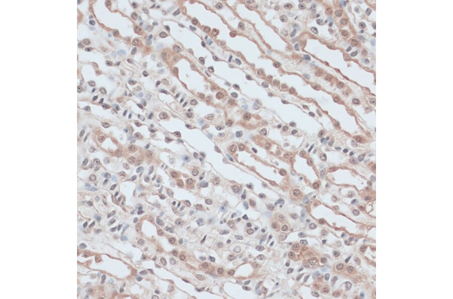 Immunohistochemistry - Anti-ZNF581 Antibody (A87624) - Antibodies.com