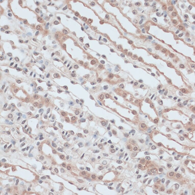 Immunohistochemistry - Anti-ZNF581 Antibody (A87624) - Antibodies.com
