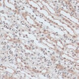 Immunohistochemistry - Anti-ZNF581 Antibody (A87624) - Antibodies.com