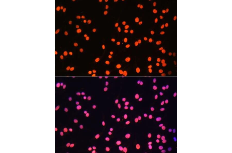 Immunofluorescence - Anti-ZNF581 Antibody (A87624) - Antibodies.com