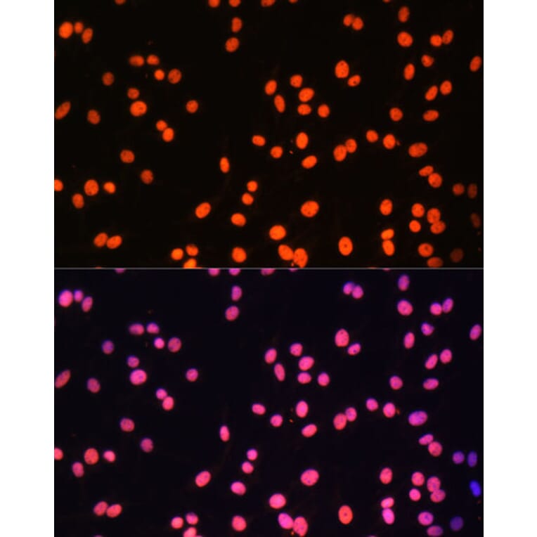 Immunofluorescence - Anti-ZNF581 Antibody (A87624) - Antibodies.com