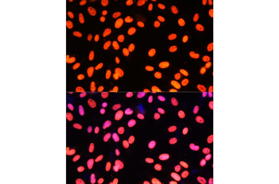 Immunofluorescence - Anti-ZNF581 Antibody (A87624) - Antibodies.com