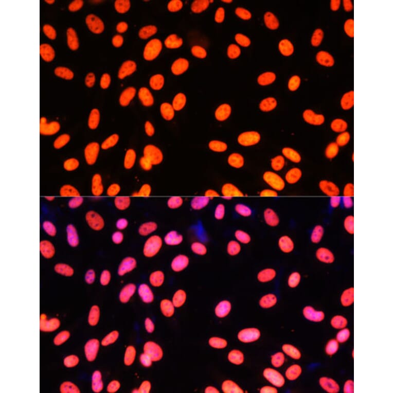 Immunofluorescence - Anti-ZNF581 Antibody (A87624) - Antibodies.com