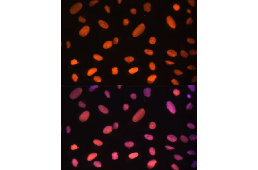 Immunofluorescence - Anti-ZNF581 Antibody (A87624) - Antibodies.com