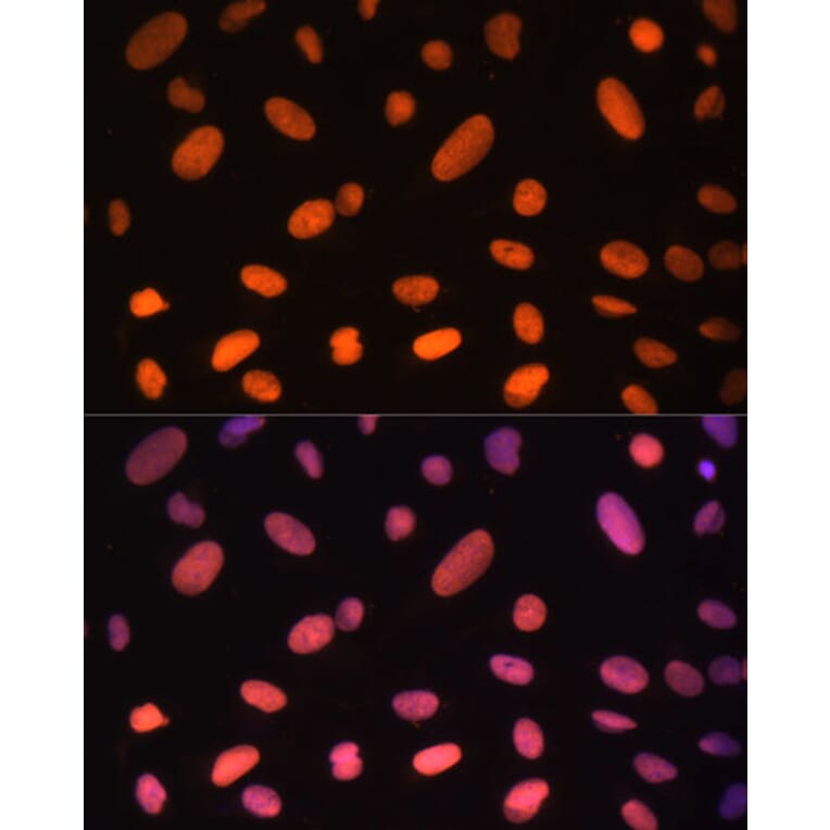Immunofluorescence - Anti-ZNF581 Antibody (A87624) - Antibodies.com